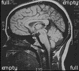 brain